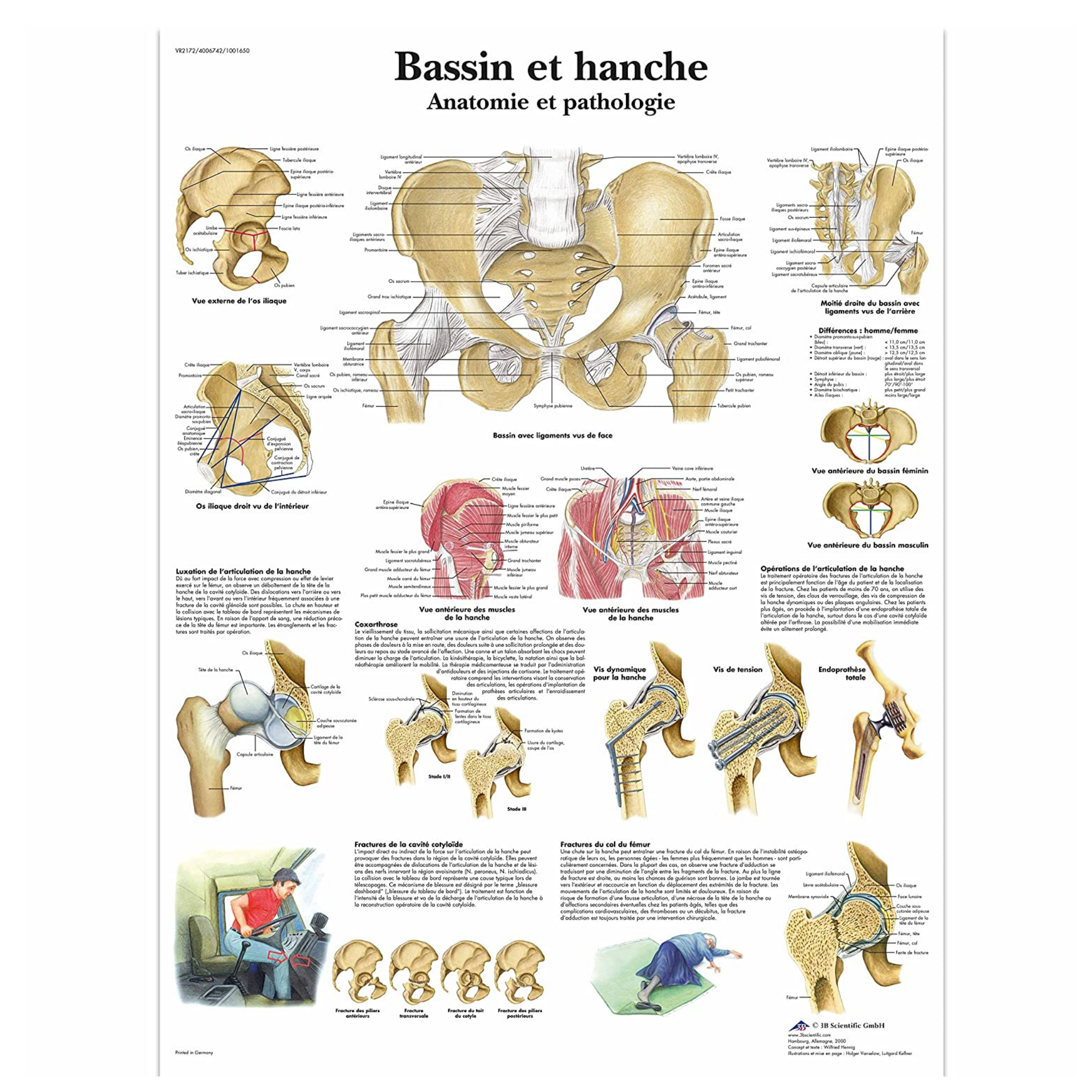 Planche anatomique - Bassin et hanche - Anatomie et pathologie - 3B Scientific